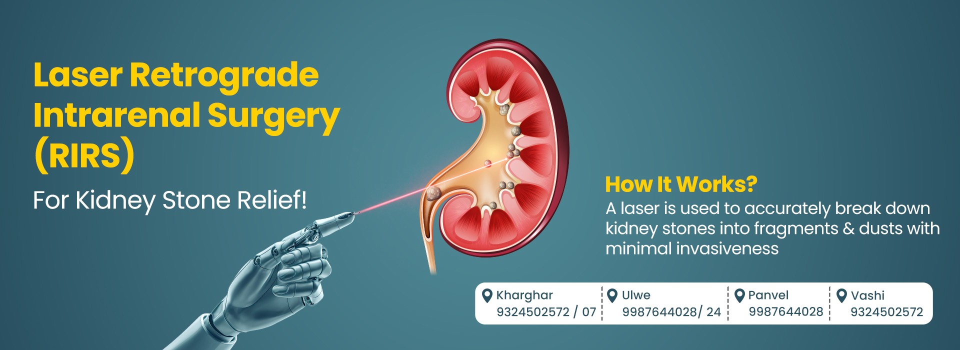 Best treatment for urinary problems at MITR Urology Associates and Hospital in Navi Mumbai, with centres at Panvel, Kharghar, Ulwe, and Vashi.