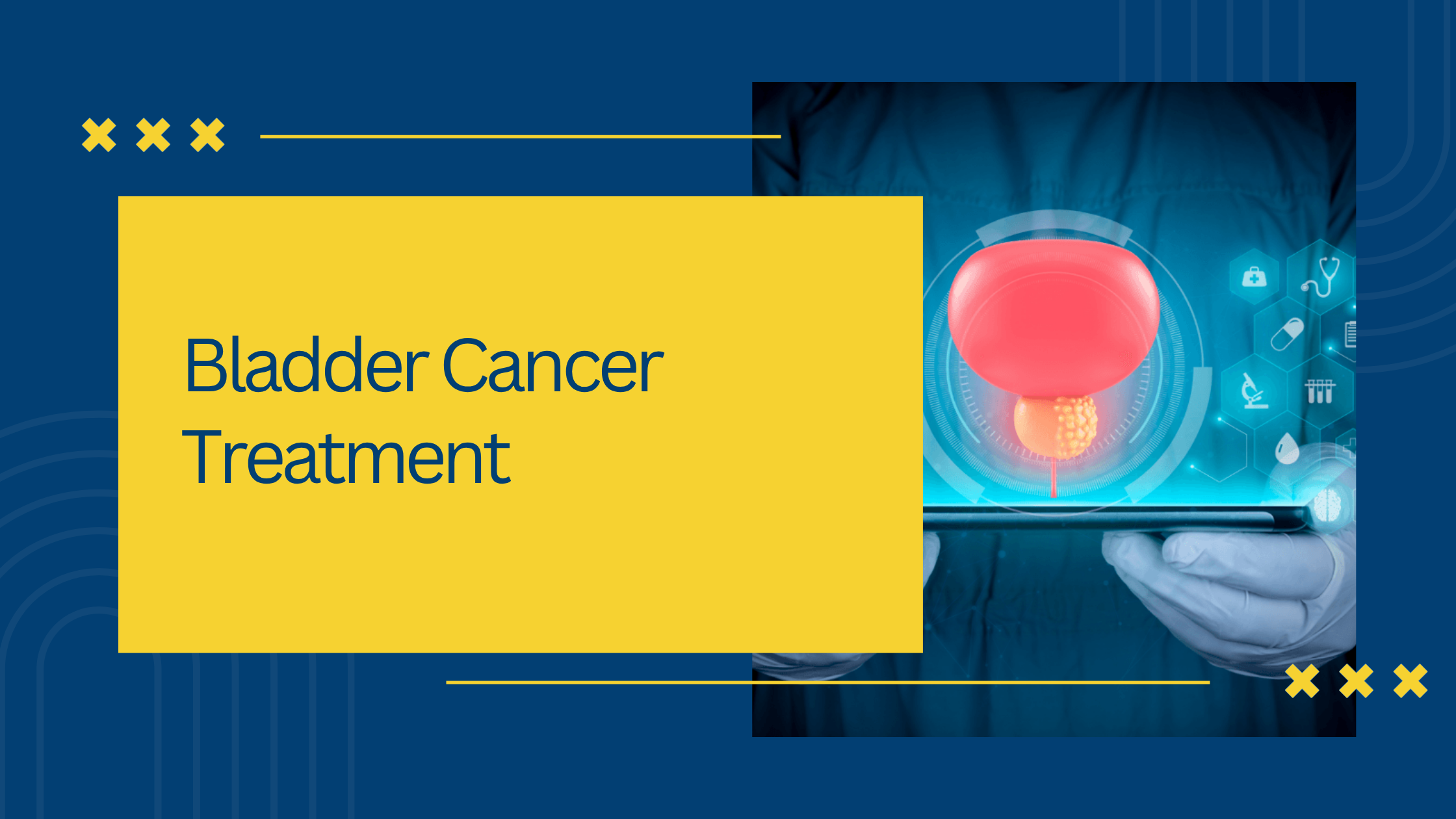 Bladder Cancer Treatment Options Explained