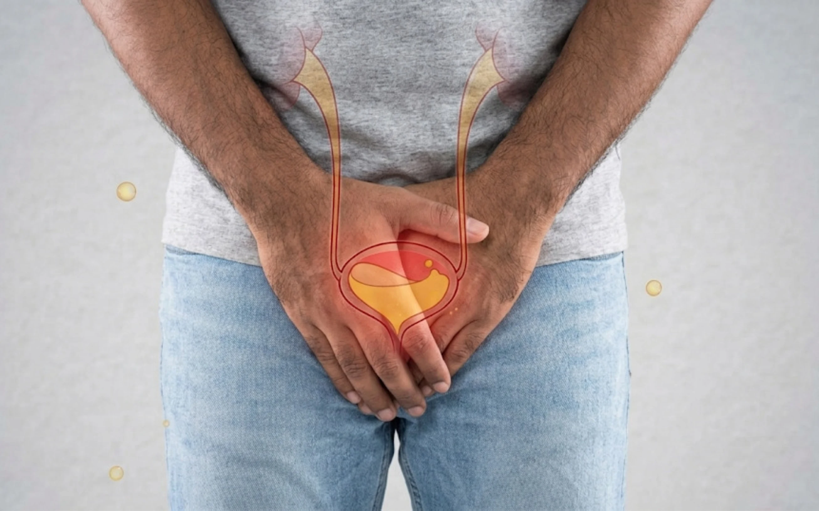 Bladder Cancer Recurrence: Why Follow-Up Is So Important