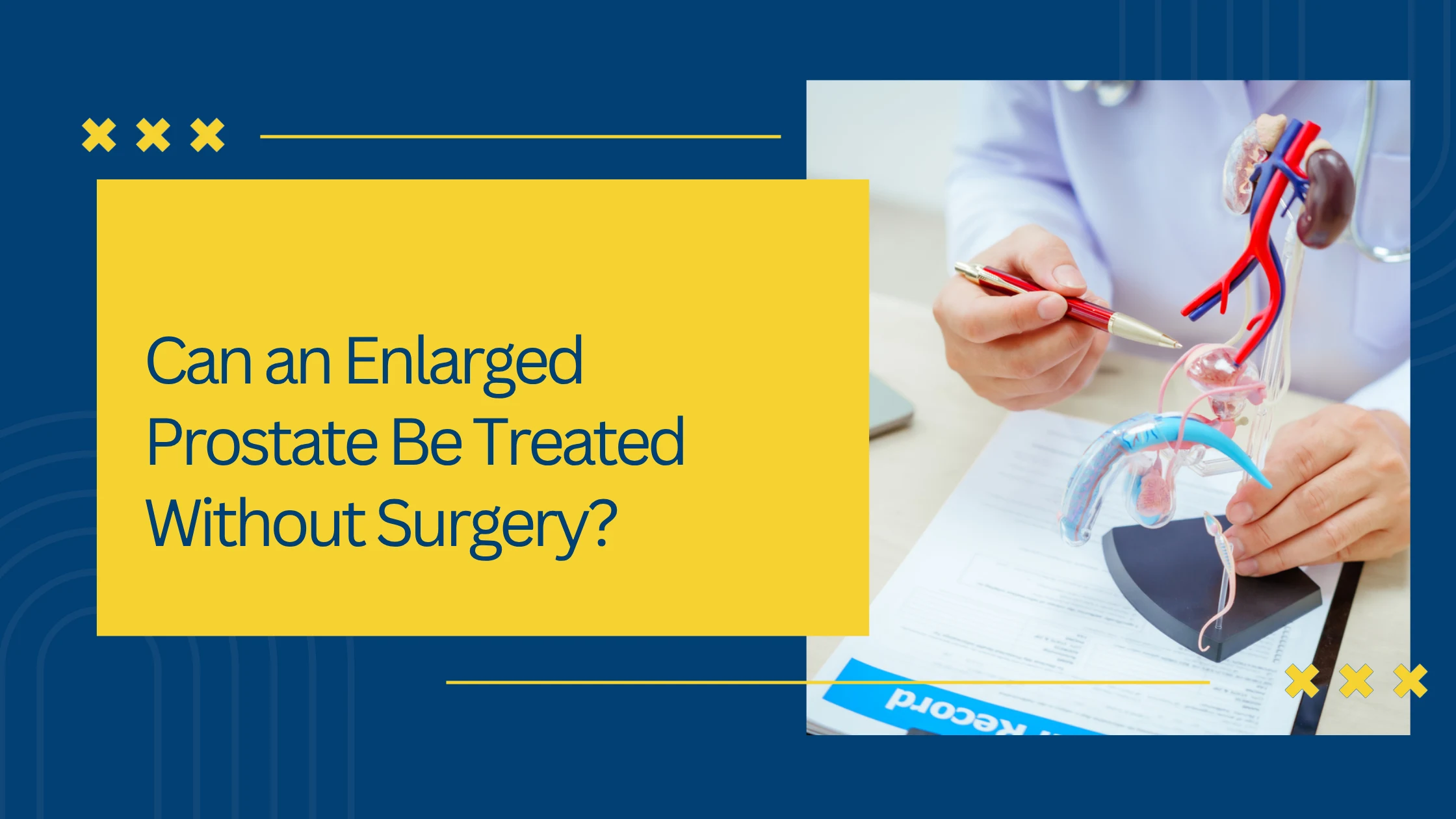 Can an Enlarged Prostate Be Treated Without Surgery?