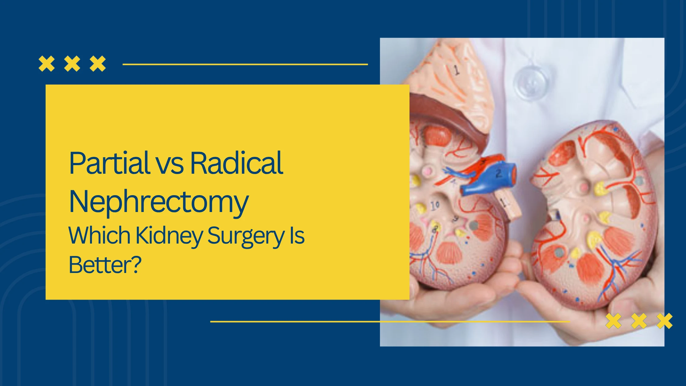 Partial vs Radical Nephrectomy: Which Kidney Surgery Is Better?