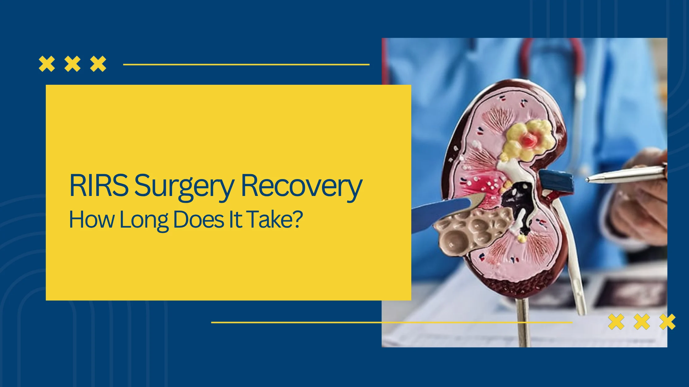RIRS Surgery Recovery: How Long Does It Take?