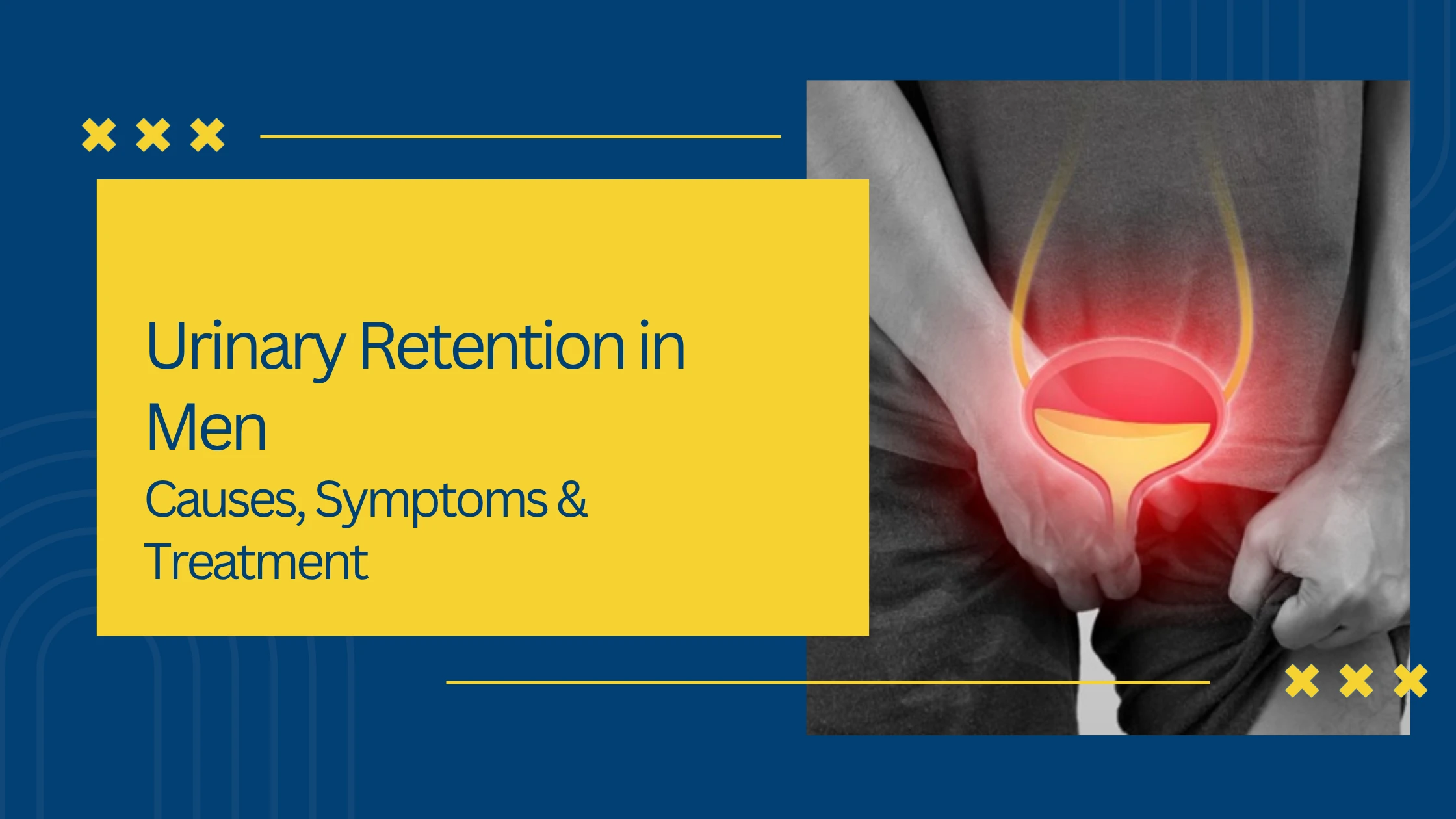 Urinary Retention in Men: Causes, Symptoms & Treatment