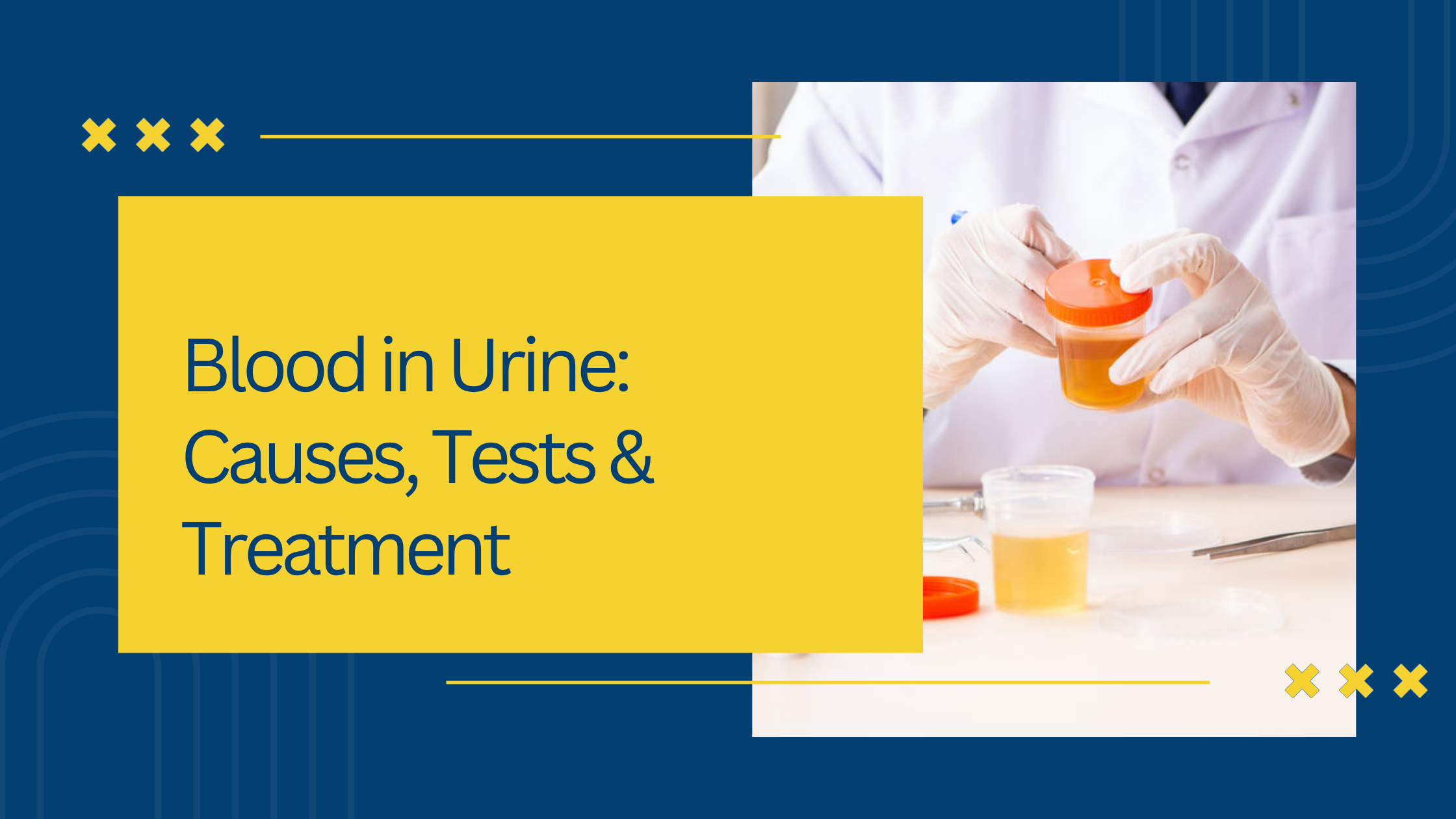 Blood in Urine: Causes, Tests & Treatment