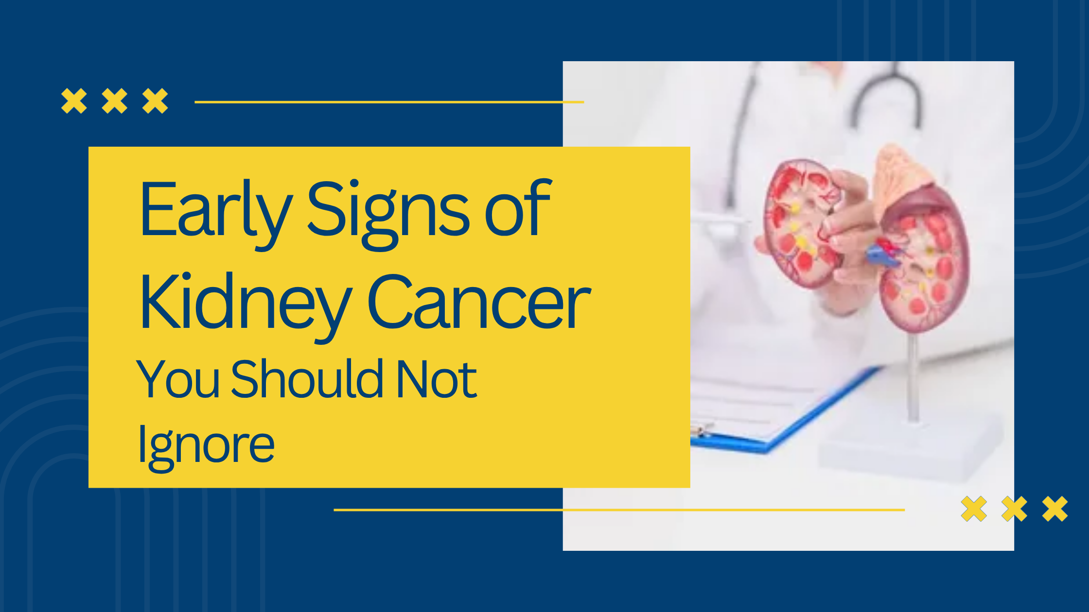 Early Signs of Kidney Cancer You Should Not Ignore