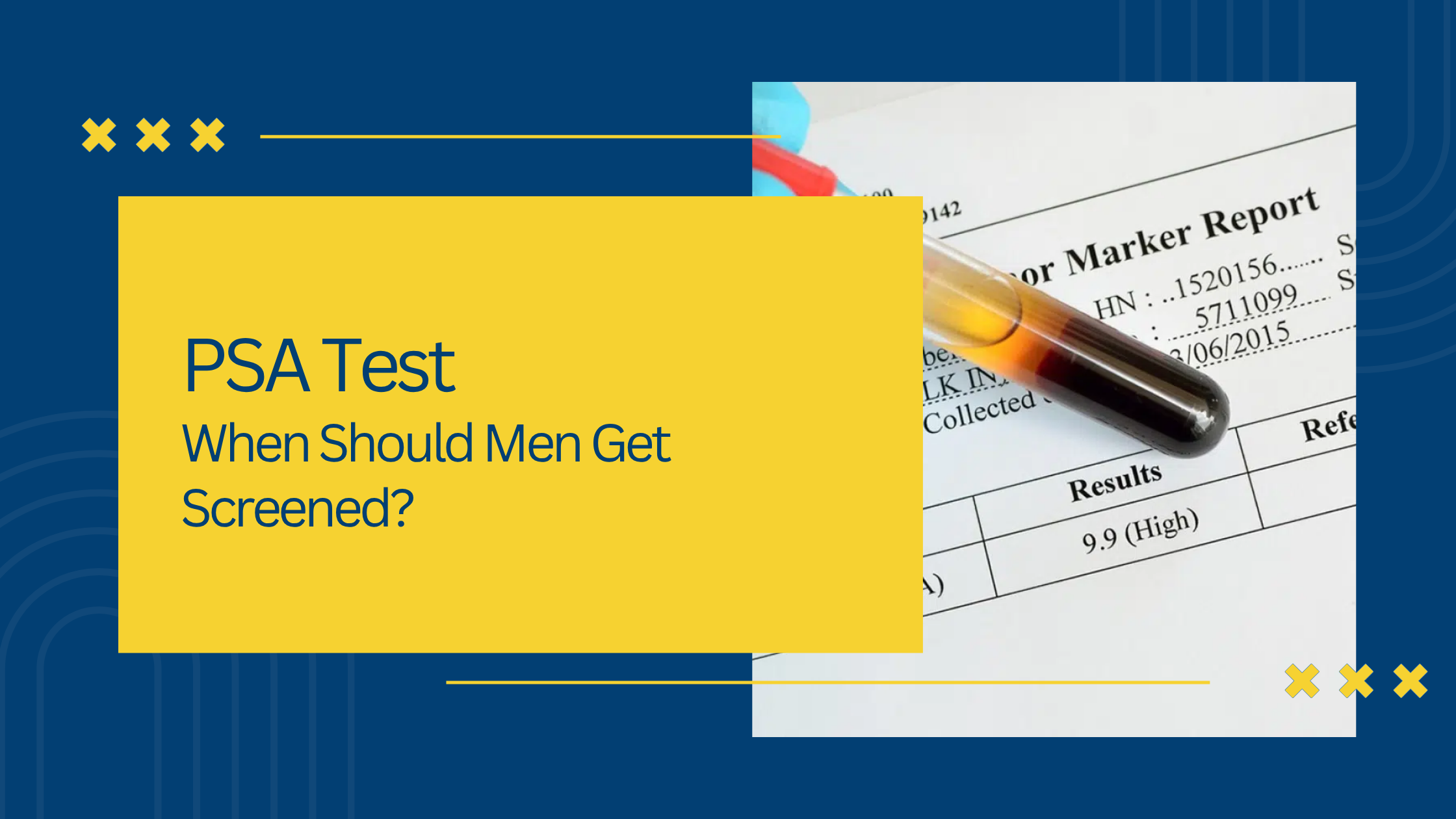 PSA Test Explained: When Should Men Get Screened?